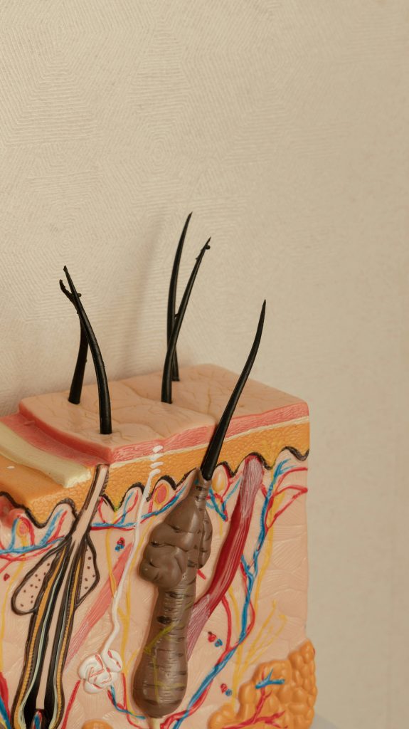Comment déboucher une glande de meibomius bouchée ?