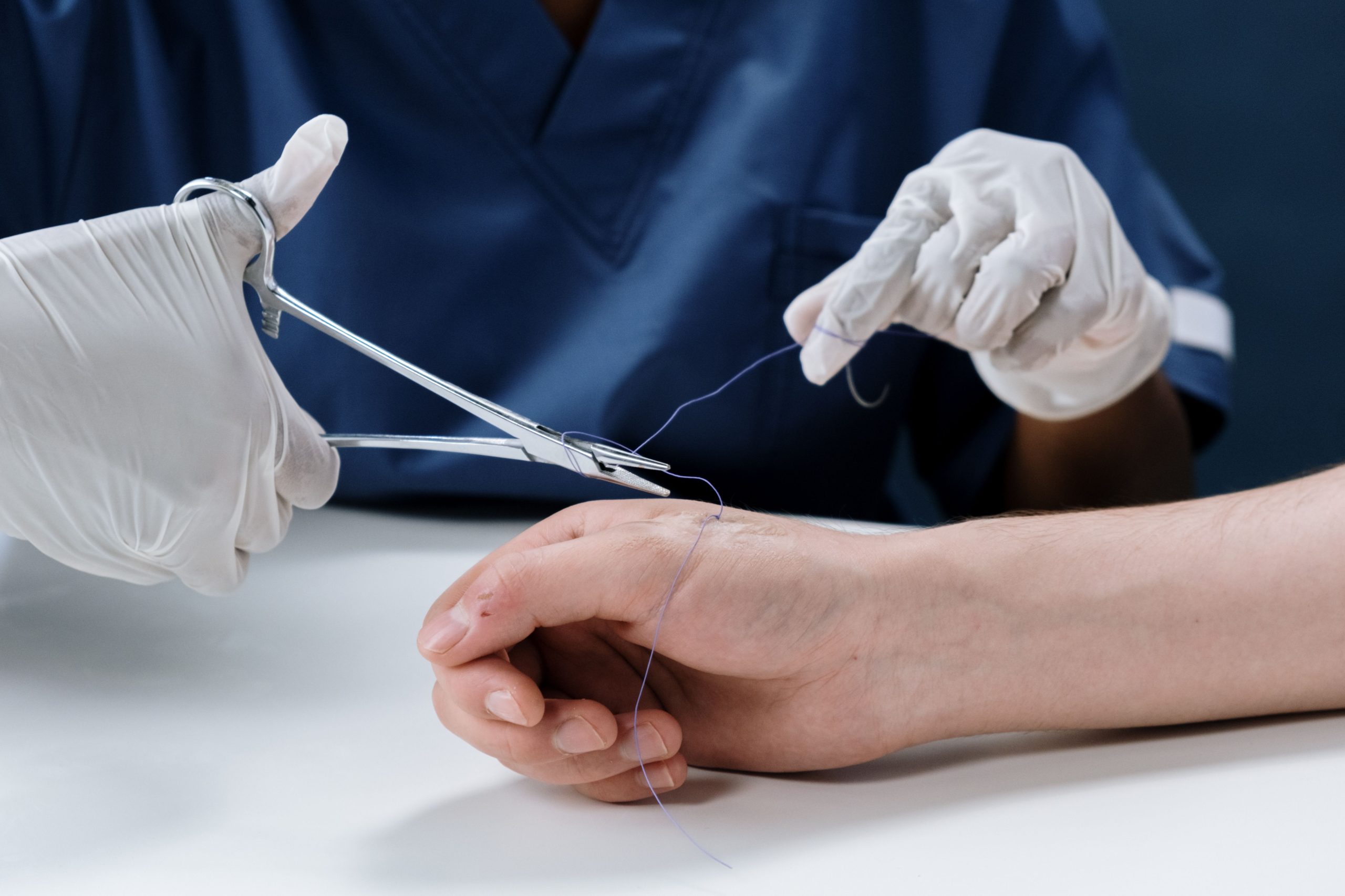 Hyménotomie et risques du nerf dentaire expliqués
