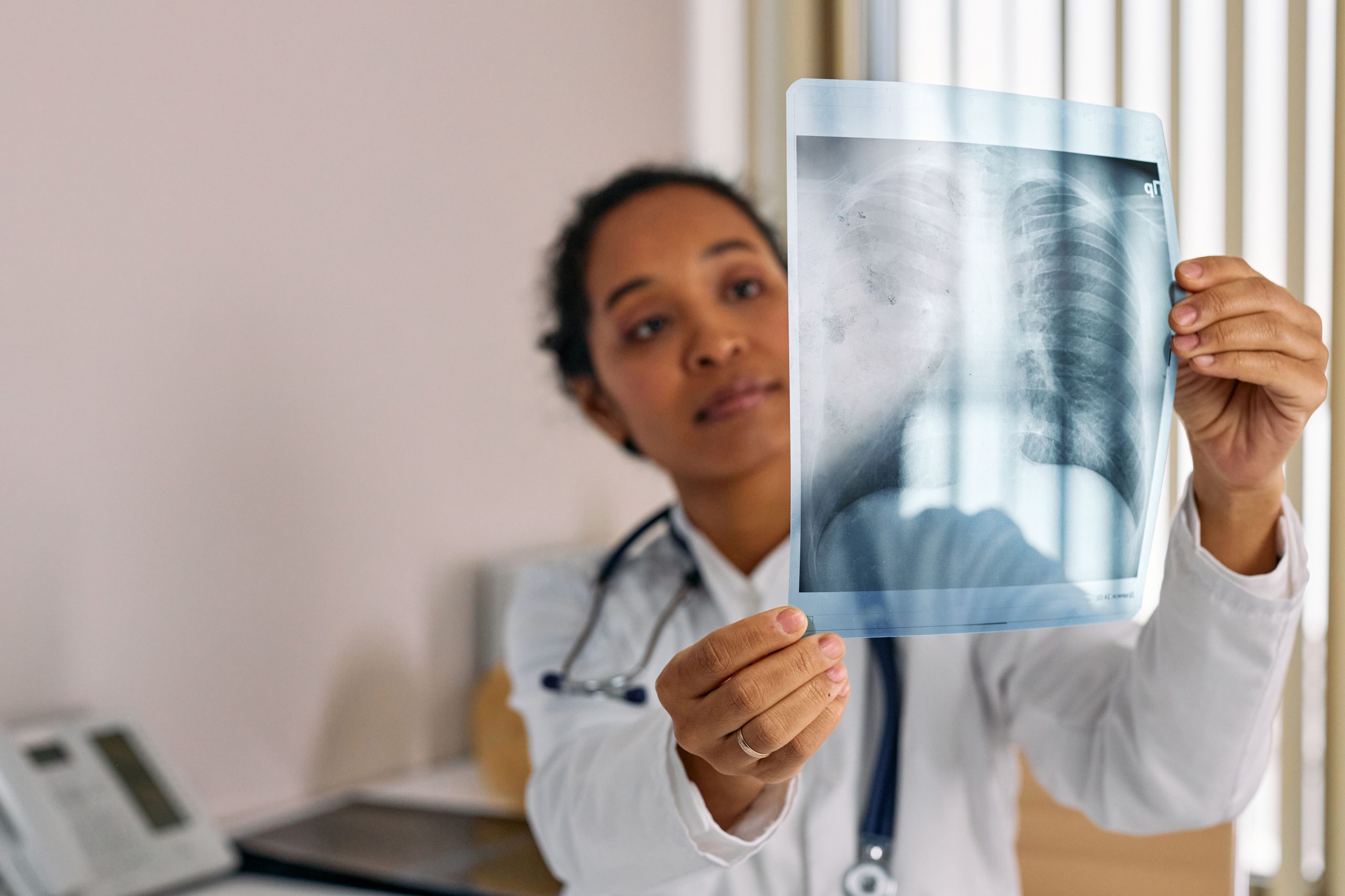 Professionnel de santé analysant radiographie thoracique