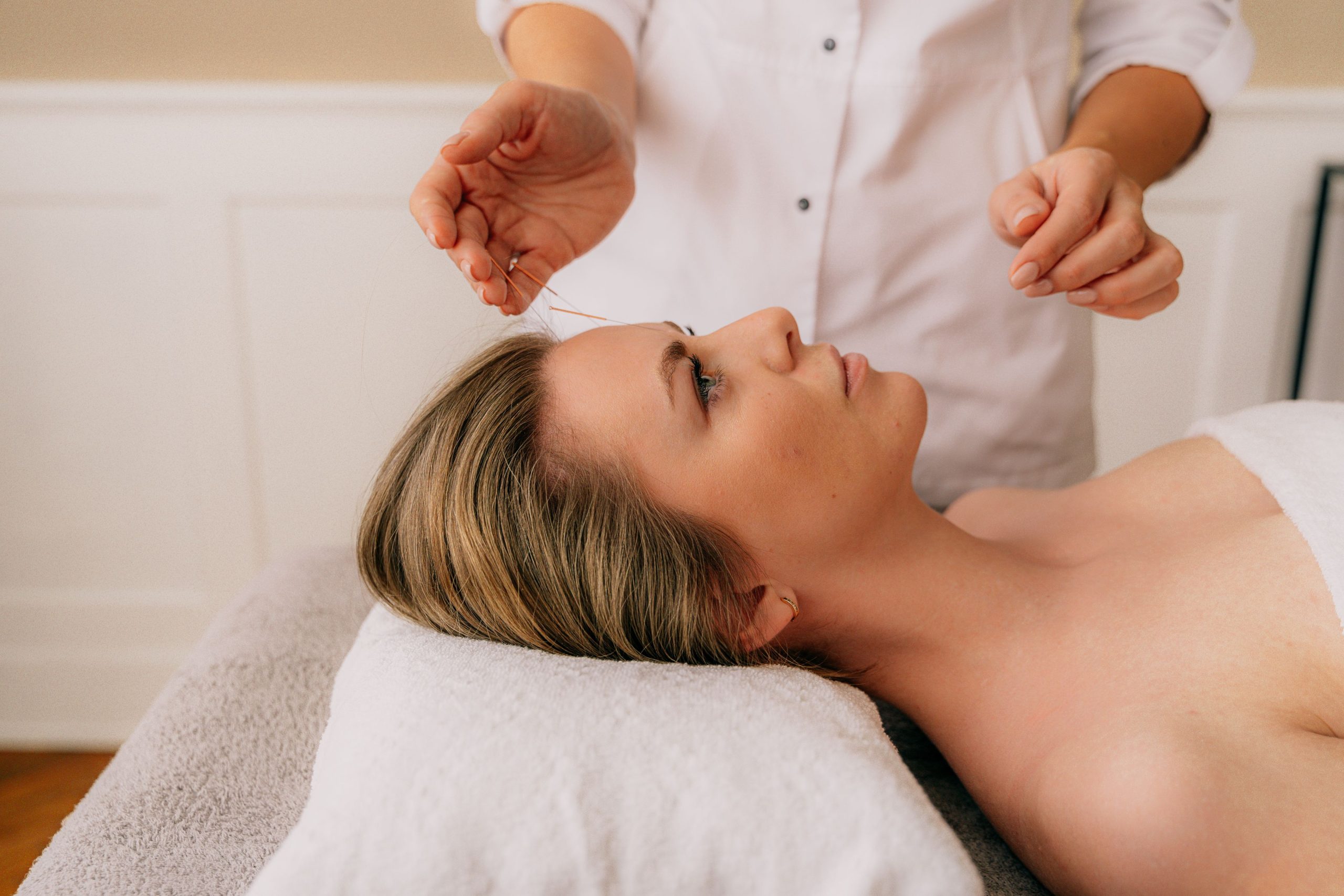 Femme en seance acupuncture environnement calme