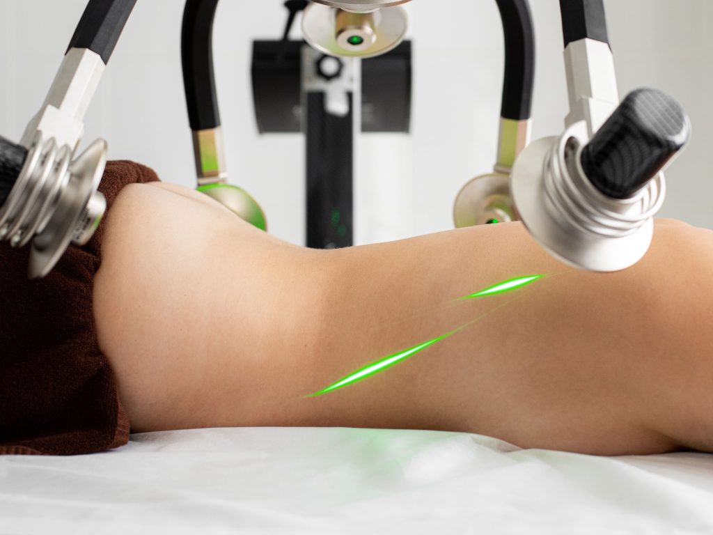 Prix séance cryolipolyse : comment t&rsquo;y retrouver ?