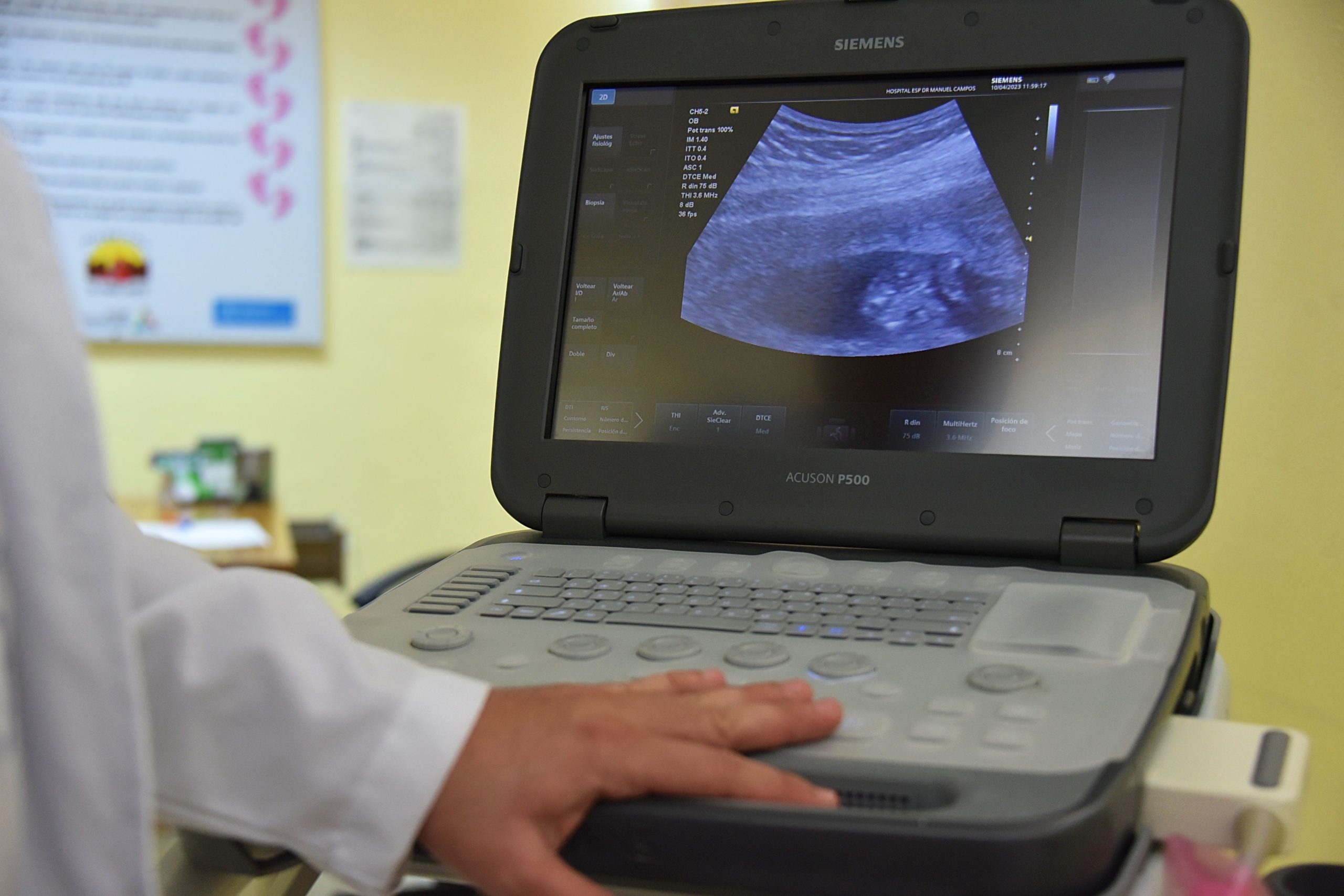 Docteur effectuant un examen echographique medical